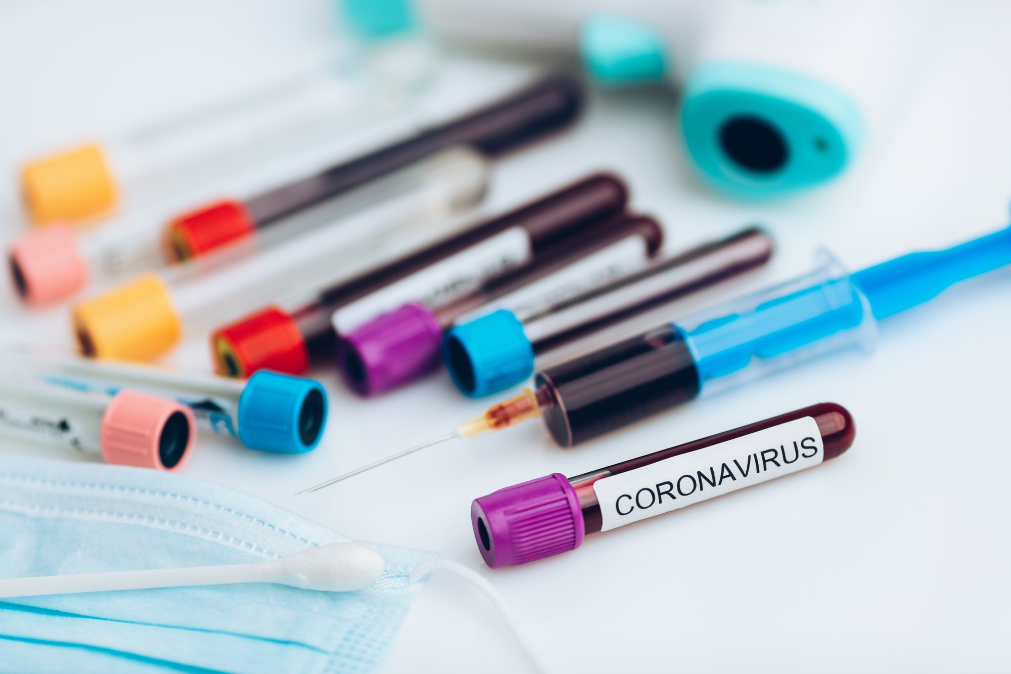 Laboratory sample of the novel Coronavirus